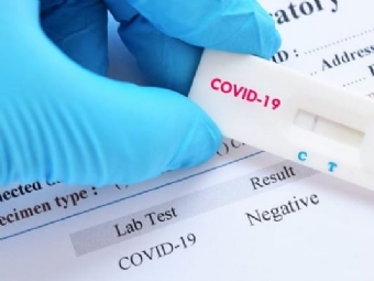 Comcam: teste de Covid-19  liberado a todas as pessoas com sintomas da doena