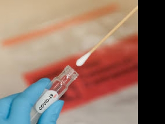 Agncia Brasil explica diferena dos testes para covid-19 e Influenza